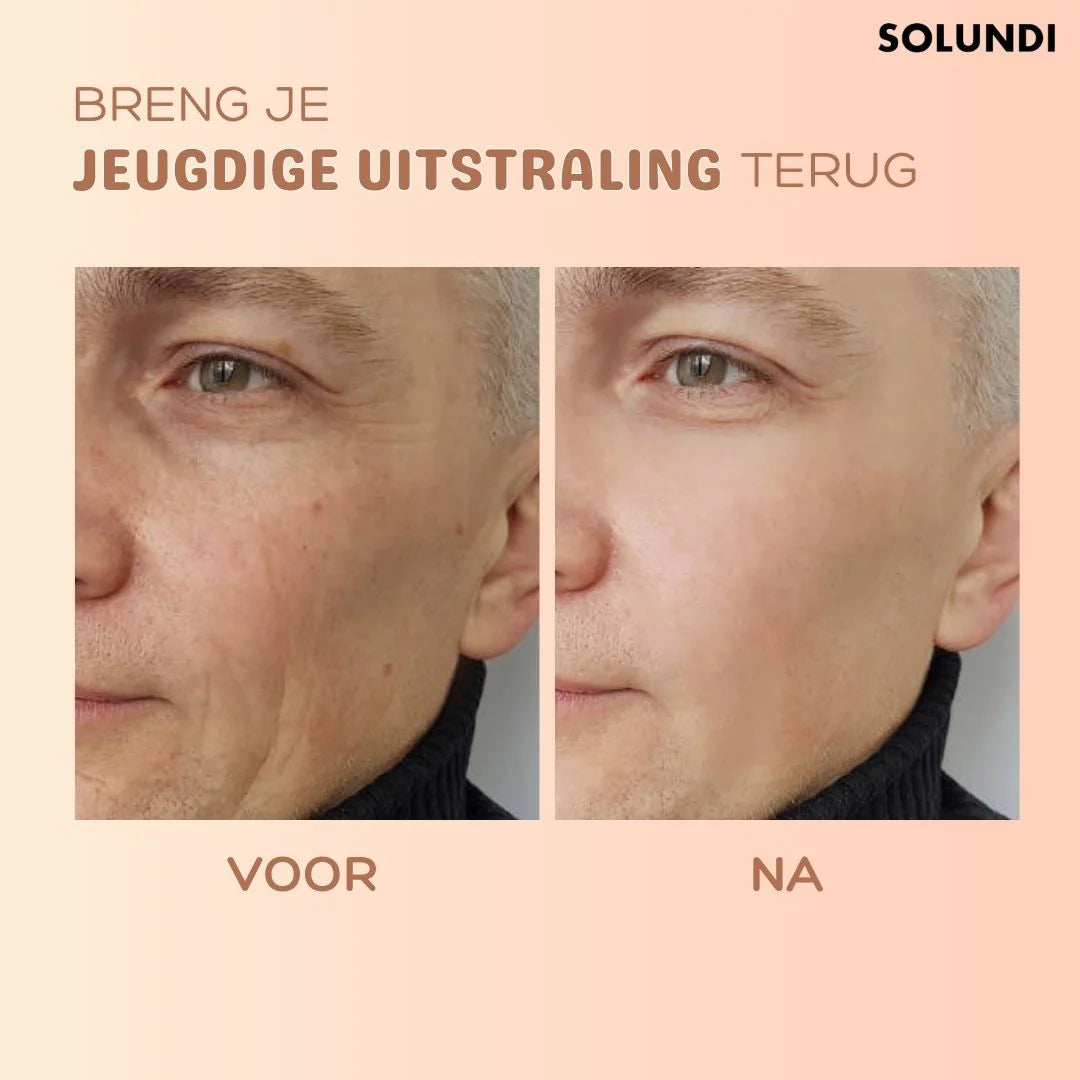 TIJDELIJK 1+1 GRATIS | Multibalm™ - Anti-Rimpel Huidvernieuwingsbalsem