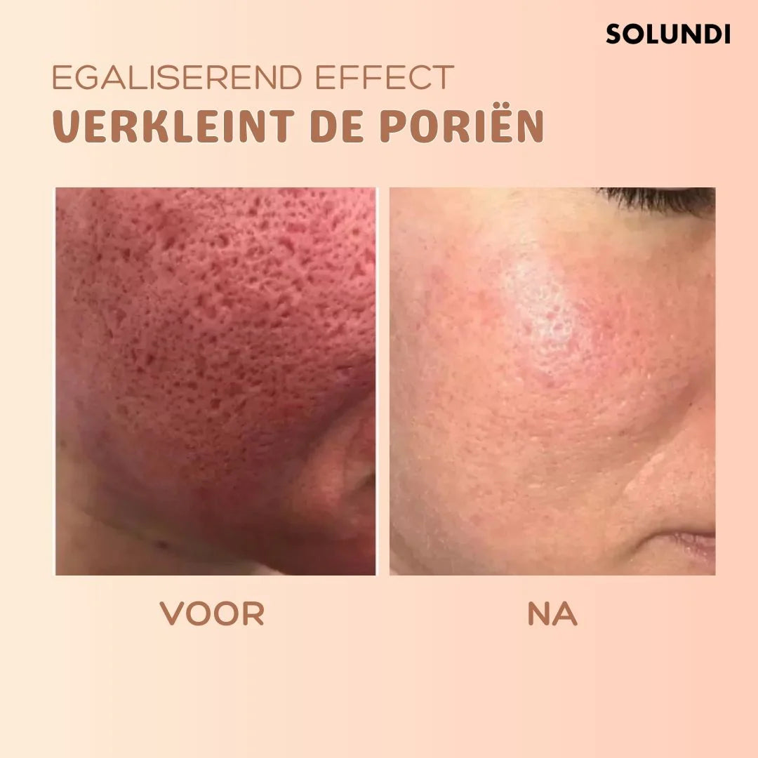 TIJDELIJK 1+1 GRATIS | Multibalm™ - Anti-Rimpel Huidvernieuwingsbalsem
